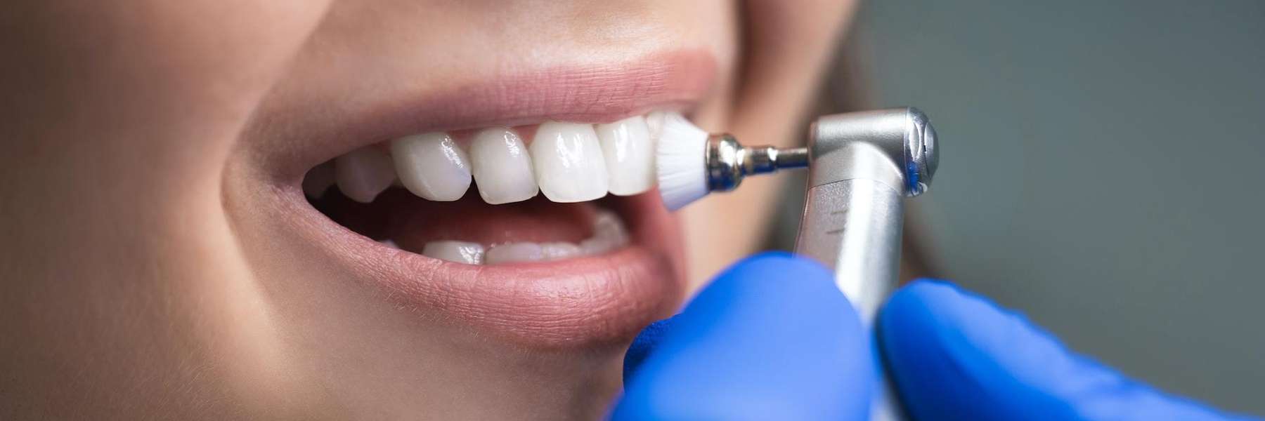 The Importance of Regular Check-Ups with a Family Dentist in Chico, CA